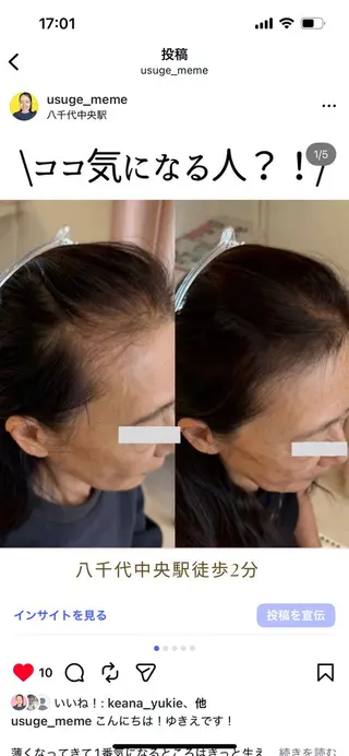 毛穴専門店MeMe.八千代店所属・毛穴・頭皮 専門店💪のその他イメージ