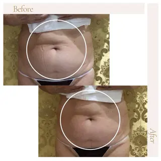 アイアンド ネイルデイのエステ・リラクイメージ