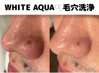 WHITE AQUA 🌼柏店のエステ・リラクイメージ
