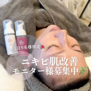 🌿ニキビ・毛穴🤍 横浜ハーブピーリングのエステ・リラクイメージ
