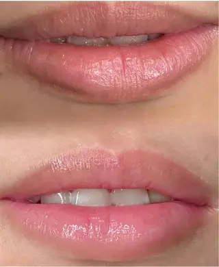 【ローマピンク施術】 Kaoのその他イメージ