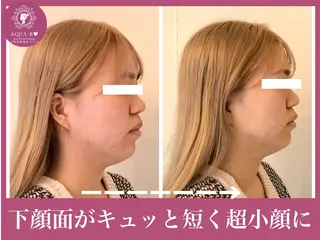 盛れる小顔矯正師 たく先生のエステ・リラクイメージ