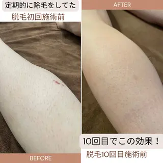 夕希 毛穴と脱毛特化サロンのエステ・リラクイメージ