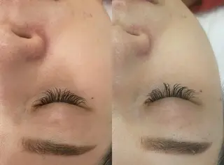 aliaハーブ水光店 エステティシャン募集のエステ・リラクイメージ