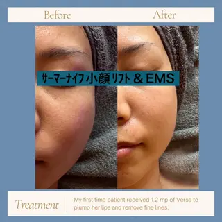 tokyosalon麻布十番所属・アラフォーでも20代 の肌になるサロンのエステ・リラクイメージ