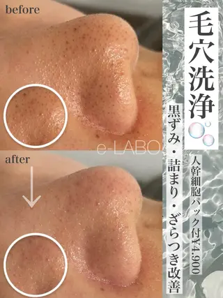 e-LABO こいずみのエステ・リラクイメージ