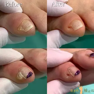 巻き爪補正店　柏店所属・巻き爪補正店 柏店のその他イメージ