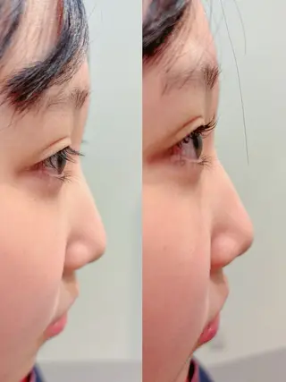 マツエク・マツパ I'LL（アイル）浜松三方原店所属・【モデルさん募集中 🎀平井】のマツエク・マツパデザイン