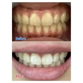 Ｍ渋谷 ホワイトニングのエステ・リラクイメージ