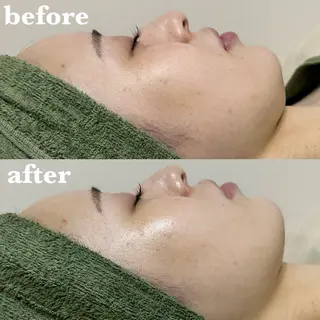 メンズ 肌質改善＆脱毛 【M Mondo】のエステ・リラクイメージ