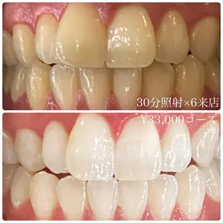 メンズ ホワイトニング ルーム　川崎店のその他イメージ