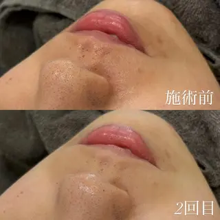 艶肌デトックス🫧 Samiraのエステ・リラクイメージ