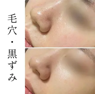 ハーブピーリング専門 BIOPLUS+川崎のエステ・リラクイメージ