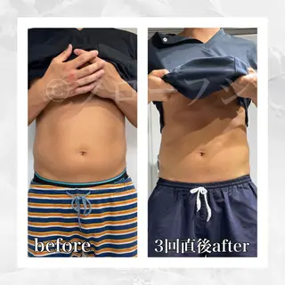 部分痩せ♥️小顔専門 MIKUのエステ・リラクイメージ