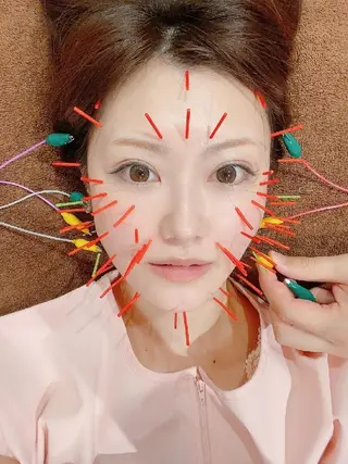 ソリーシェ鍼灸院 立野のエステ・リラクイメージ