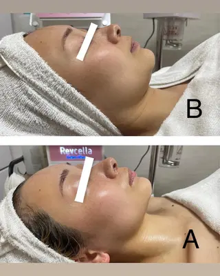 ビューティーサロン B.glossyのネイルデザイン