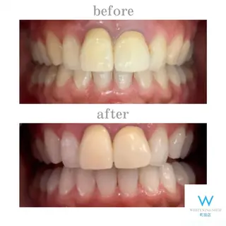 メンズ キッズ ホワイトニング ショップ町田店のその他イメージ