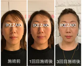 美容鍼 IKEZAKIのエステ・リラクイメージ