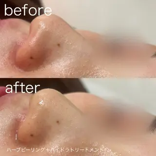 lulularico Yuのエステ・リラクイメージ