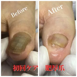 メンズ ネイル ドクターネイル爪革命 takahashiのその他イメージ