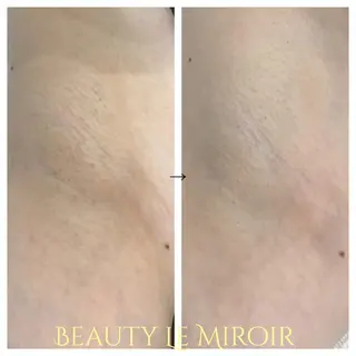 ビューティー ミロワールのエステ・リラクイメージ