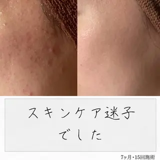 ニキビ経験者が施術 する専門サロン🌻のエステ・リラクイメージ