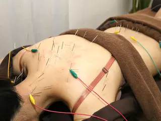 Spring鍼灸院 ✨首肩こり、腰痛に！のその他イメージ