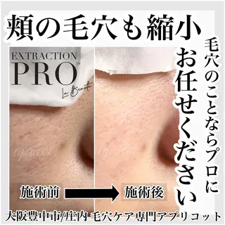 ヘッドスパ専門/豊中 apricotのエステ・リラクイメージ