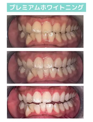 韓国式3D毛穴洗浄 lonhanaのその他イメージ