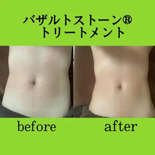 ビューティーサロンLEMO所属・ビューティーサロン Lemoのエステ・リラクイメージ