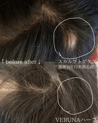 メンズ 毛穴改善サロン d'Alba大阪住吉のエステ・リラクイメージ