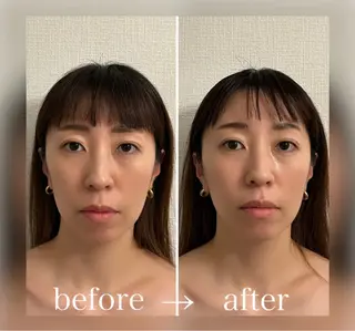 小顔セラピー LILのエステ・リラクイメージ