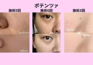 マツエク・マツパ aliaハイフ&水光ジェットサロン所属・aliaハーブ水光店 エステティシャン募集のエステ・リラクイメージ