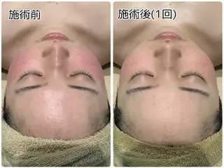 美容カイロ ShuShuのエステ・リラクイメージ