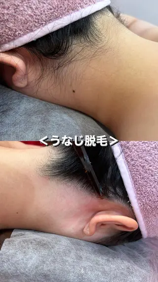 WAX・肌質改善・毛 穴洗浄/林愛真のエステ・リラクイメージ