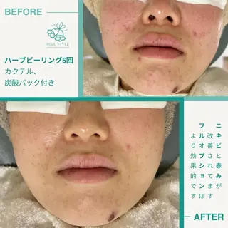 メンズ キッズ 【脱毛・美肌専門】 bellstyleのエステ・リラクイメージ