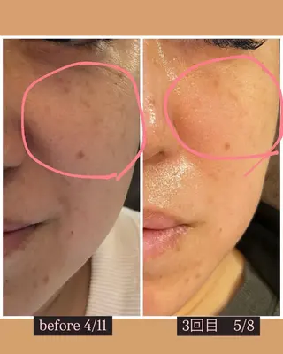 〚博多〛フィユ 水江のマツエク・マツパデザイン