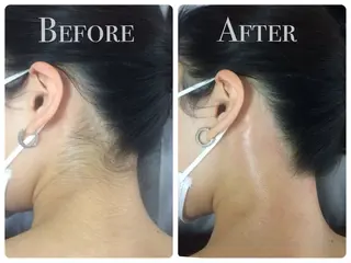 Lam..肌質改善 専門 女性専用サロンのエステ・リラクイメージ