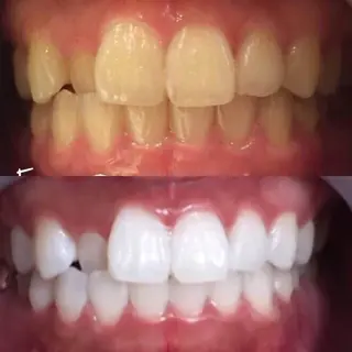 M渋谷 ホワイトニングのエステ・リラクイメージ