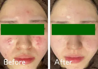 フェイシャル＆痩身 カンフリエ✨七田のその他イメージ