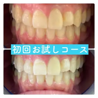 ホワイトニングルーム 横浜店のその他イメージ