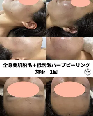 VIKI BEAUTY  クレイハーブピーリング・美肌脱毛専門店所属・VIKI BEAUTYのエステ・リラクイメージ