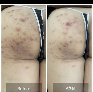 Lilas所属・痩身・リンパ専門 Lilas広島駅前店のその他イメージ