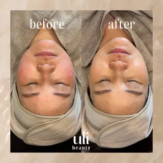韓国肌管理サロン ulibeautyのエステ・リラクイメージ