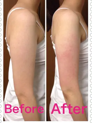 メンズ 朝重い人専用 肩甲骨調整のエステ・リラクイメージ