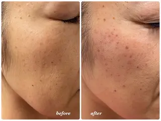 MUJIGE  ✴︎ mamiのエステ・リラクイメージ