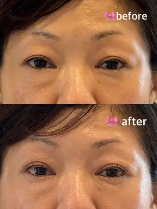 マツエク・マツパ TSUNA 🌙 Lim 五反田のマツエク・マツパデザイン