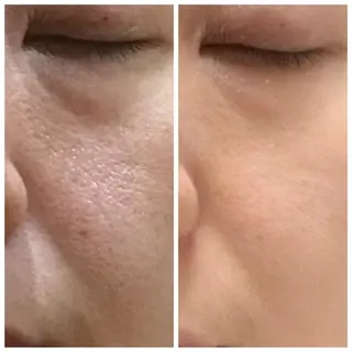 山崎 愛子のエステ・リラクイメージ