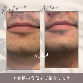 メンズ Salon  LUMINA所属・真栄平 美咲のエステ・リラクイメージ