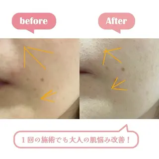 エステサロン BlooMeのエステ・リラクイメージ